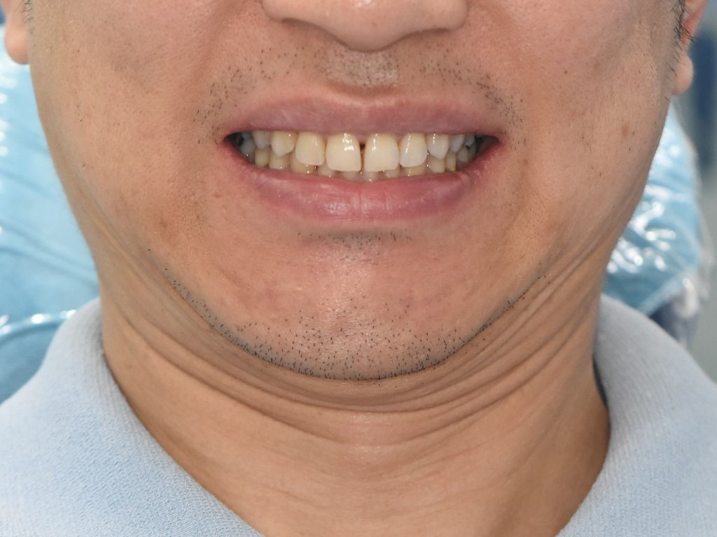 Case 01 — before treatment